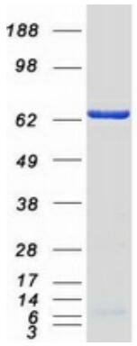 Coomassie blue staining of purified EIF2A protein.